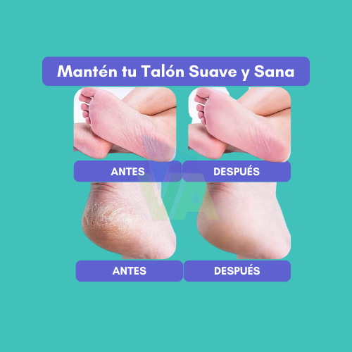 Limador de Callos Eléctrico